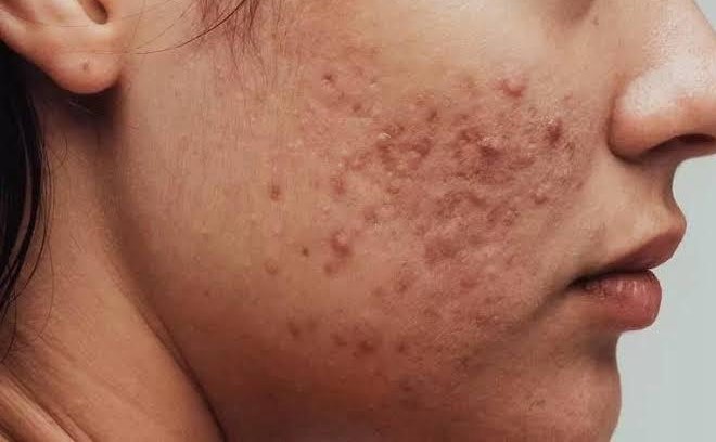 skin dr nanda hatwar